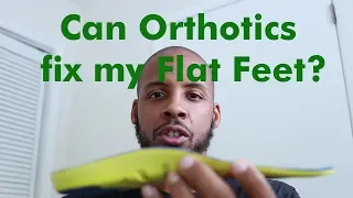 Can Orthotics fix Flat Feet