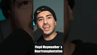 Floyd Mayweather hat plötzlich Haare und einen Bart | Haartransplantation & Barttransplantation