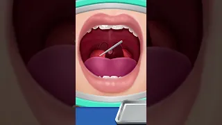 [ASMR] Removal of tonsils