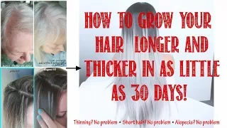 How to grow your hair quickly! No more thinning!