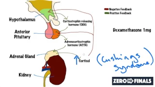 Understanding The Dexamethasone Suppression Test