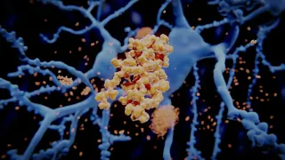 Alzheimers disease amyloid bet