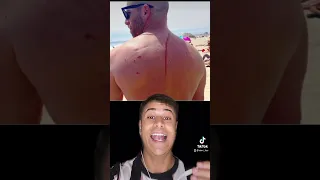 El Ataque De Un Tiburón Salvó La Vida De Este Hombre #shorts