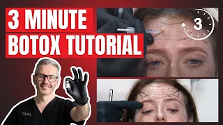 Simple Botox Tutorial | Common Botox Patterns | Botox Units Guide