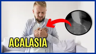 Acalasia, o que é ? - Sintomas, diagnóstico e tratamento - (Disfagia e Megaesôfago)