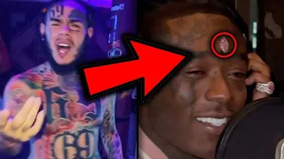 Rappers React To Lil Uzi Vert $24 MILLION Diamond Forehead Implant