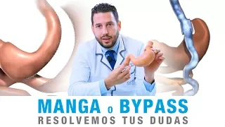 Diferencias entre Bypass Gástrico y Manga Gástrica | Clínicas Diego de León