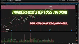 How to Place a Physical Stop Loss on ThinkorSwim® Active Trader