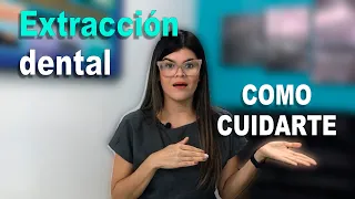 Extracción dental | Cuidados e Indicaciones