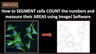 How to SEGMENT cells and COUNT the numbers and MEASURE their AREAS using ImageJ Software