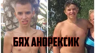 БЯХ БОЛЕН ОТ АНОРЕКСИЯ *МОЯТА ИСТОРИЯ*