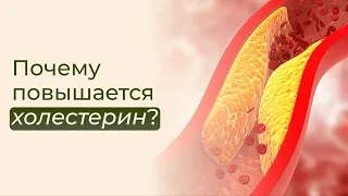 Для чего нужен холестерин и ОПАСЕН ЛИ? Как снизить холестерин? Нужно ли пить статины?