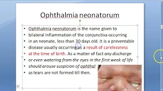 Ophthalmology Neonatal Conjunctivitis Ophthalmia Neonatorum Causes Eye Discharge in Baby Newborn