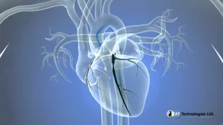 Cateterismo cardiaco. Pacientes