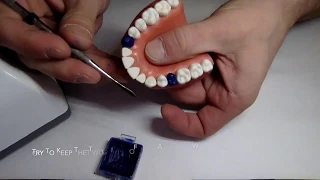 Dental School Wax Up - Tooth #11 full contour crown