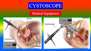 CYSTOSCOPE - Definition ,types , parts, uses , Precautions,  How to use ? - Surgical Devices