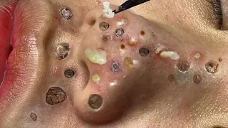 Make Your Day Satisfying with An Popping New Videos #26