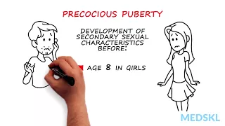 Pediatrics – Abnormal Pubertal Development: By Paola Luca M.D.