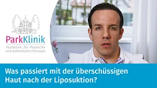 Was passiert mit der überschüssigen Haut nach der Liposuktion?