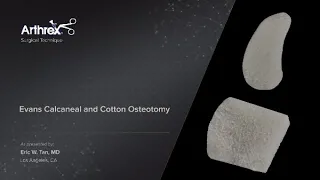 Evans Calcaneal and Cotton Osteotomy