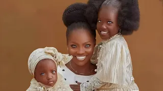 Remember The Black Twins With Different Eyes? This Is what Happened To Them!