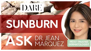 Sunburn | Ask Dr. Jean Marquez #summer #sunburn