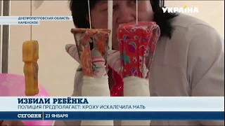 Сломанные ноги, бедра и ребра: мать избила свою 11-месячную малышку