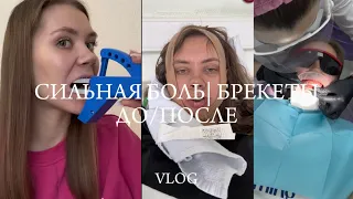 ЧЛХ ОПЕРАЦИЯ | ПОСЛЕДСТВИЯ | БОЛЬ ВНЧС | БРЕКЕТЫ ДО