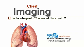 2 CT chest - prof.Mamdouh Mahfouz (2019 edition)