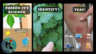 Poison Ivy Remedy Experiment + URUSHIOL SCIENCE  | Koaw Nature