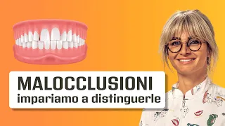 Malocclusioni - cosa sono e come si differenziano