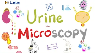 Urine Microscopic Examination (RBCs, WBCs, Casts,…etc) | Urinalysis