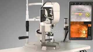 Navilas® Retinal Laser"