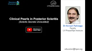 Clinical Pearls in Posterior Scleritis