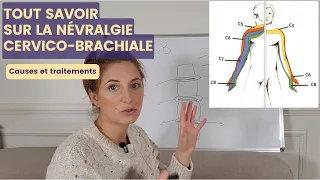 NÉVRALGIE CERVICO-BRACHIALE : cause et symptômes (pour mieux agir ensuite !)