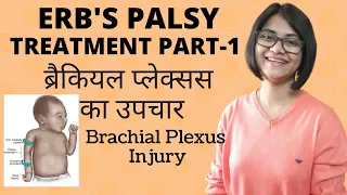 ERB'S PALSY TREATMENT IN HINDI|ब्रैकियल प्लेक्सस का उपचार| Brachial Plexus Injury| BABY CARE| Part 1