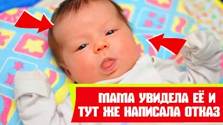 Когда родители этой девочки увидела её ножки и ручки — тут же написали отказ от ребёнка, но прошло в