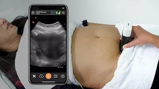 Scanning Technique: First Trimester Gestational Age