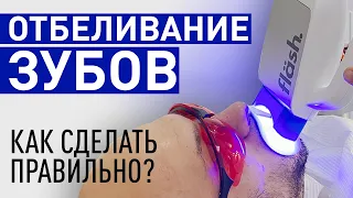 Отбеливание зубов. Делать или не делать? Все тонкости отбеливания