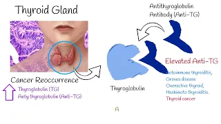 Thyroglobulin and Antithyroglobulin explained easy. TG and Anti -Tg; (TgAb)  tests