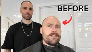 LOOK INCREDIBLY SEXY BALD With THIS STYLE