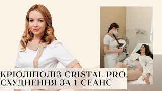 СХУДНЕННЯ ЗА 1 СЕАНС 💠 КРІОЛІПОЛІЗ CRISTAL PRO