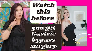 Should I get Gastric bypass surgery? - pros, cons, reality.