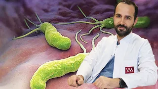 What is Helicobacter Pylori (Stomach Microbe)? How Is It Treated?