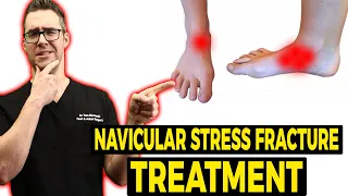 Navicular Stress Fracture Treatment [Exercise, Shoes & Stretches]