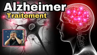 L'Alzheimer - TOUT Savoir : Traitements, Physiopathologie, Recherche, Plaques Amyloïdes, Tau