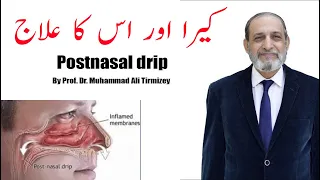 Postnasal drip I By Prof. Dr. Muhammad Ali Tirmizey