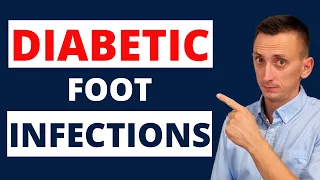 Diabetic Foot Infections: Treatment