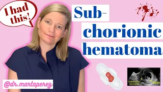 OBGYN Explains Subchorionic Hematoma | My Story First Trimester Bleeding