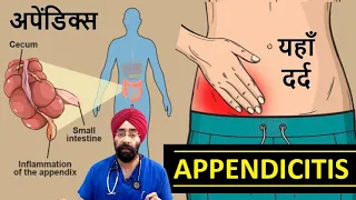 Appendicitis | अपेंडिक्स | Right Lower abdominal Pain | Dr.Education